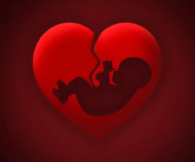Catholic teaching on what happens to unbaptized Children when they die
